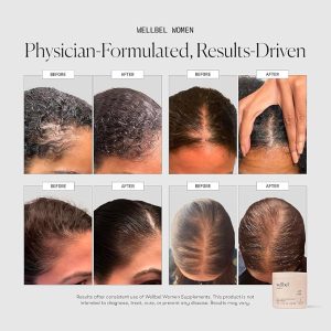 gluten free beauty supplement